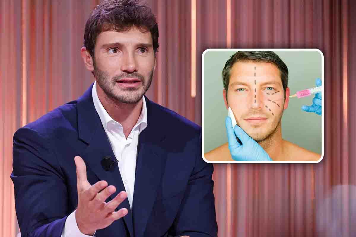 stefano de martino ritocchini estetici